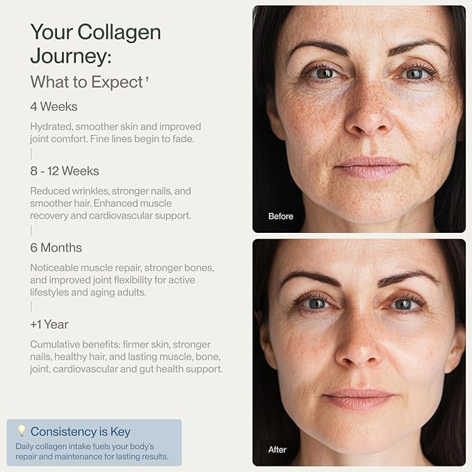 Colla Vita Collagen Peptides Powder Grass-Fed Pasture-Raised Hydrolyzed Collagen Powder, Type I & III Hair, Nails, Skin and Joints, Non-GMO, Paleo & Keto, Unflavored, 32 Fl oz. 90 Servings