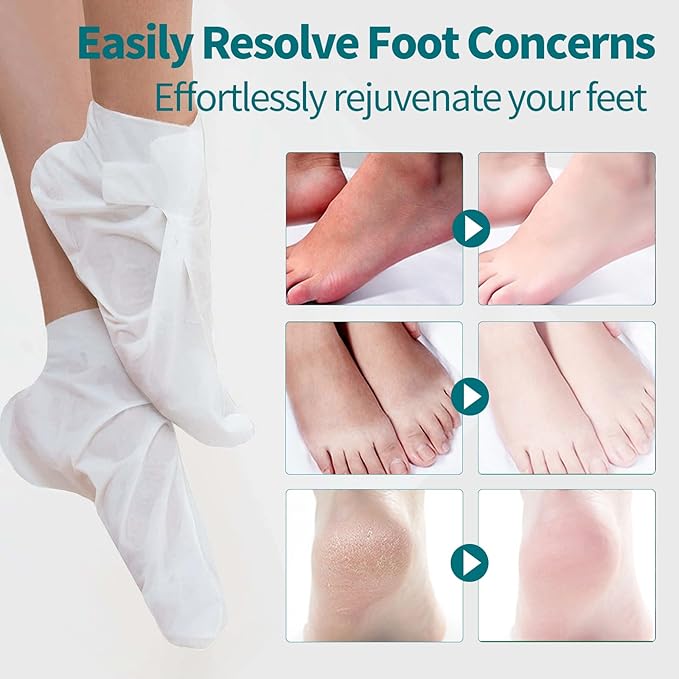 Moisturizing Foot Mask 5 Pack,Hydrating Foot Masks for Dry Cracked Feet,Moisturizing Socks Dry Skin Moisturizer for Soft and Smooth Touch Feet,Foot Care Spa Gifts for Women Men Valentines Gifts
