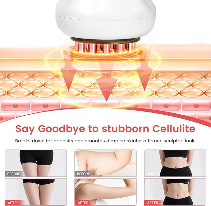 HuiPoLii Lymphatic Drainage Massager & Anti Cellulite Massage Tool, Helps Reduce Stretch Marks & Cellulite, for Legs, Arms & Belly.