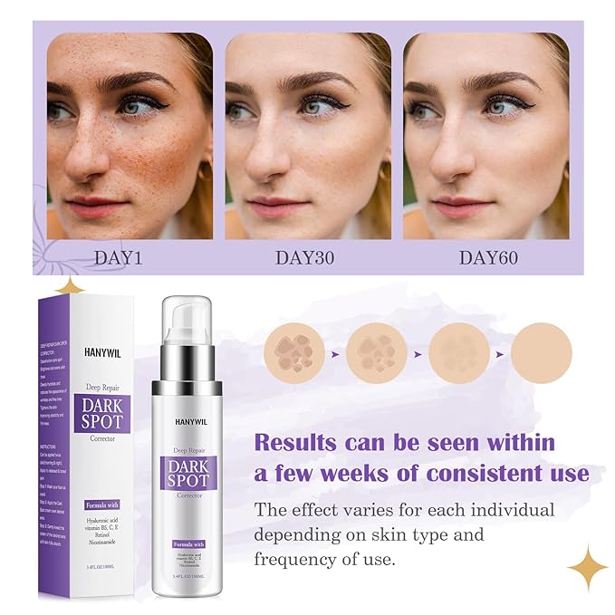HANYWIL Dark Spot Remover for Face & Body Serum,Rapid Tone Repair Cream with Hyperpigmentation Treatment,Sun Spot, Age Spot & Melasma Remover,Dermatologist-Tested Brightening Retinol Serum (3.4 Fl Oz)