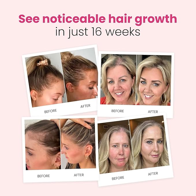 Trybello Hair Growth Shampoo | Natural Thickening & Scalp Detox | Aloe Vera, Turmeric, and Urucum Extract | Sulfate-Free, Vegan, Anti-Hair Fall Formula | For Any Hair Type | 4 Pack Combo