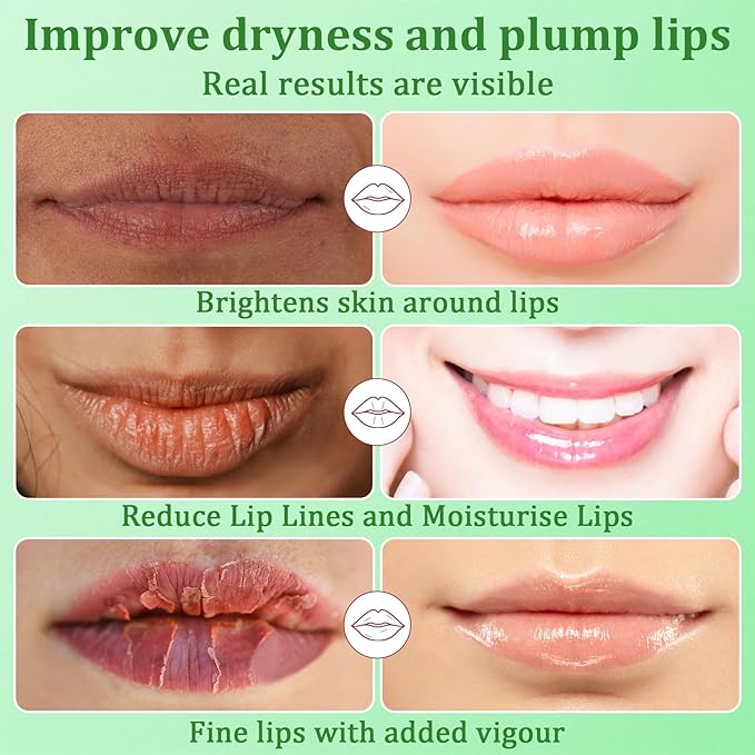 30PCS Moisturizing Lip Mask - Lip Patches for Spa Daily Labial Masks Skincare Hydrating to Reduce Wrinkles Dryness Anti-wrinkle Lightens, Avocado