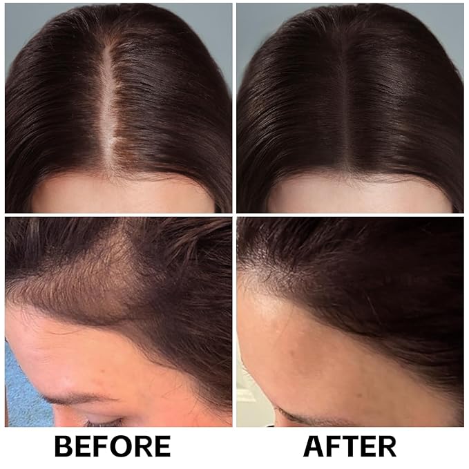Boobeen Dual Ended Gray Away Root Touch Up Stick, Long Lasting Grey Hair Coverage Touch Up for Men and Women, Temporary Thinning Hair Concealer