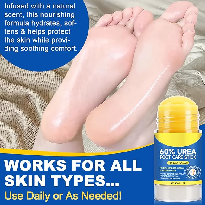 FEISIDUNWSF 60% Urea Foot Cream for Dry Cracked Heels & Feet, Hydrating Urea Cream Moisturizer for Rough, Callused Skin, Deep Repair & Softening Foot Balm, Fast Absorbing, Exfoliating Formula, 1.4oz