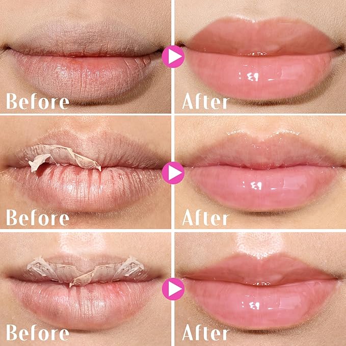 KIMUSE Lip Mask Set, Lip Sleeping Mask, Overnight Lip Treatment for Dry Lip, Flaky, Moisturizing, Vitamin C, Shea Butter & Antioxidants