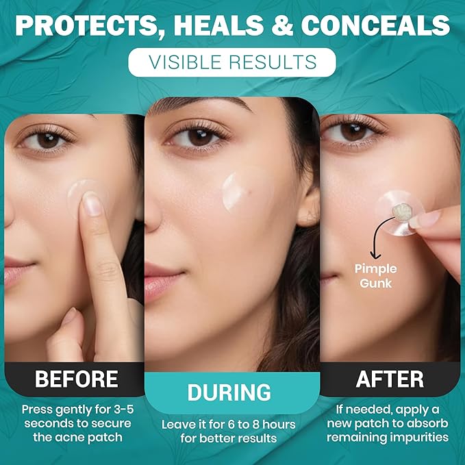 Mubo Care Pimple Patch – Hydrocolloid Acne Dots for Face, Invisible and Waterproof Blemish Spot Treatment – Fast Healing Pimple Stickers for All Skin Types (36 Count (Pack of 1))