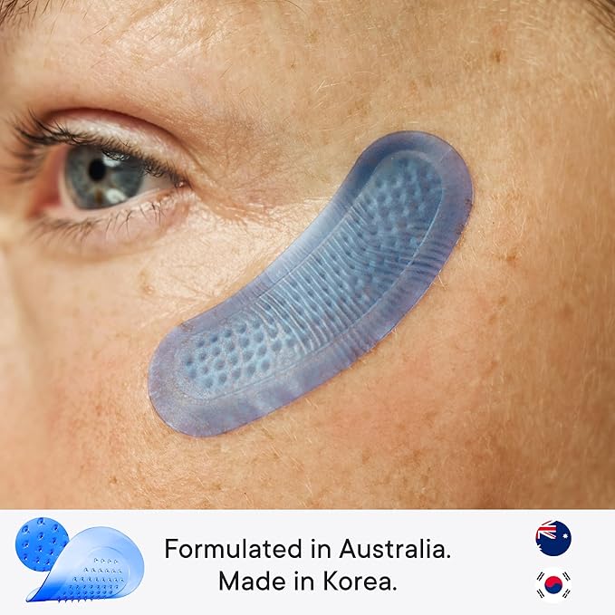 Qure Micro-Infusion Anti Wrinkle Patches for Smile Line, Frown lines, Under Eye Bags, Puffiness, Crow's Feet - Retinol, Caffeine, Peptides - Dissolvable for Overnight Use - 8 Pairs