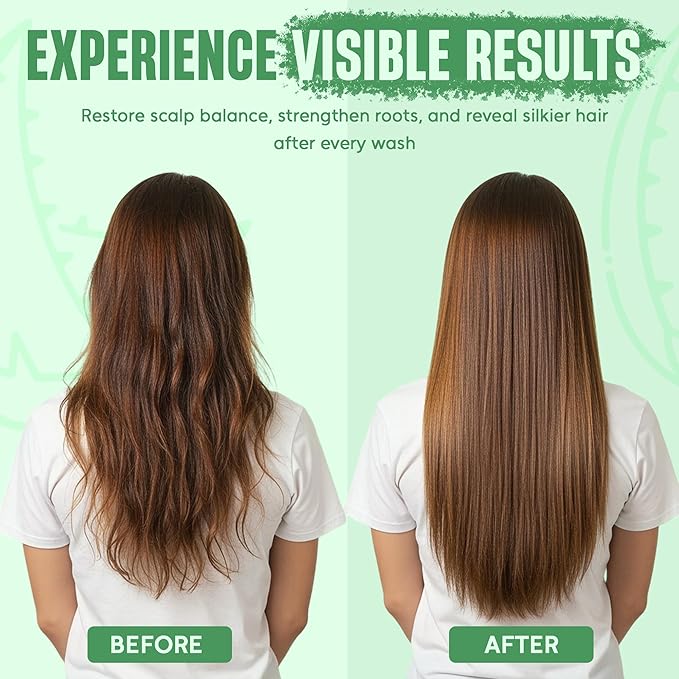 INFINA ESSENTIALS Aloe Vera Shampoo and Conditioner Set | 16 fl oz Each | with Batana Oil | Hydrating, Soothing & Moisture Balance Formula | Nourishing Care for Dry, Itchy or Sensitive Scalp