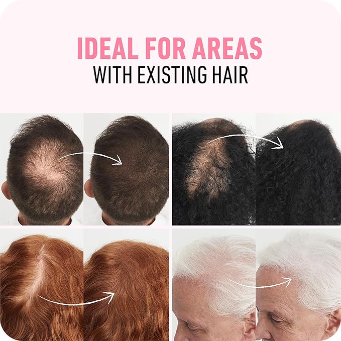 BOLDIFY Hair Fibers (28g) - Fill In Thinning and Fine Hair for an Instantly Fuller, Thicker Look - 14 Shades for Women & Men - Medium Blonde