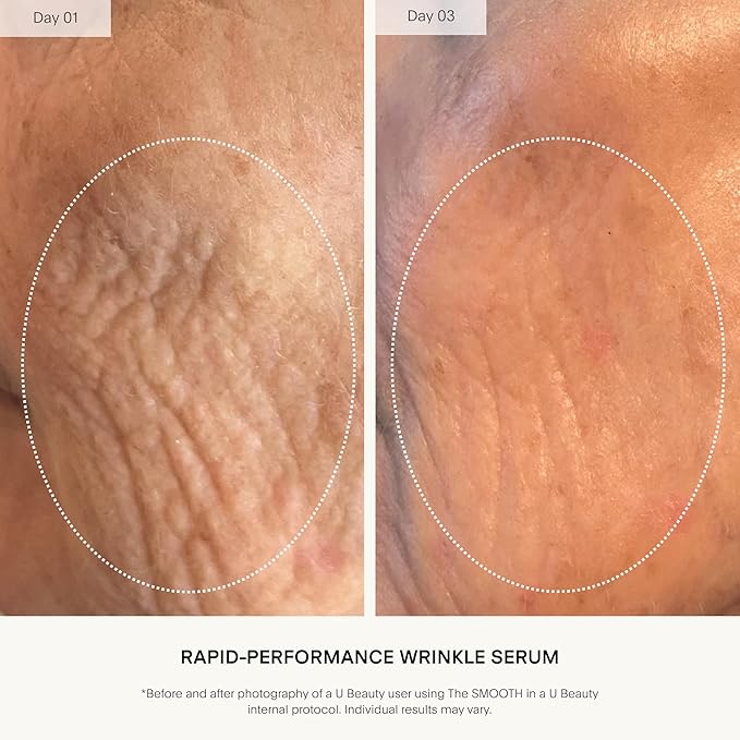 U Beauty The SMOOTH Dynamic Wrinkle Defense Serum - Multi-Peptide Complex, Copper Peptides, Retinol, Centella Exosomes, Vegan Silk Protein for Visible Wrinkle Reduction, Firming & Hydration, 15ml