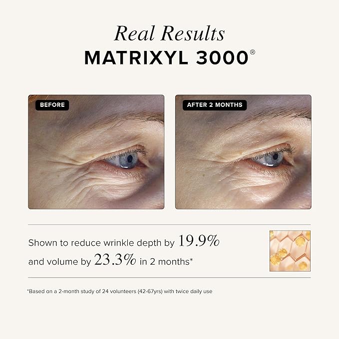 Asterwood Matrixyl 3000, Argireline Peptide, Vitamin C Cream - Triple Repair - with Hyaluronic Acid - Anti-Aging, Wrinkle Reducing, Hydrating - Fragrance-Free - 1.7 Fl Oz