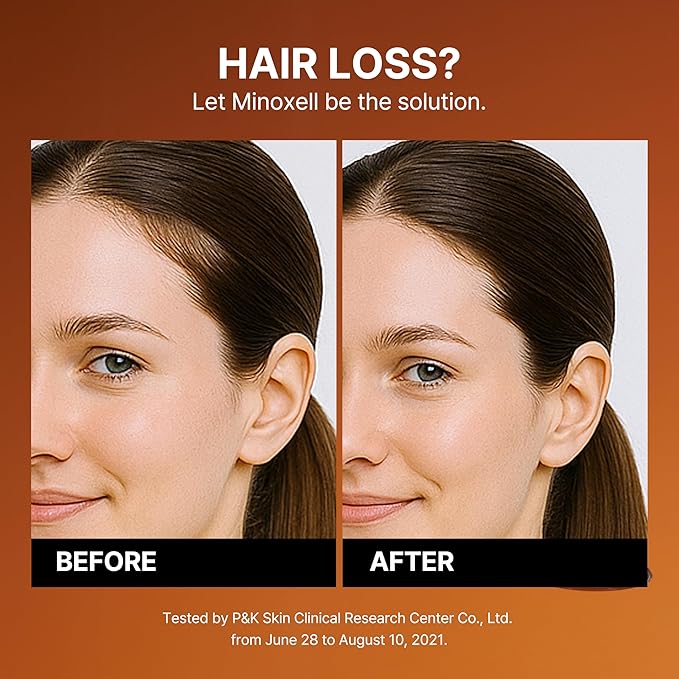 Korean Scalp Intensive Shampoo & Hair Growth Serum with Biotin | Korean Shampoo for Hair Loss, Hair Regrowth, Thinning Hair, Volume Boost & Damage Repair