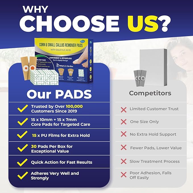 Ulensy Corn Remover Pads for Feet Toes: 30 Pack Salicylic Acid Extra Strength Treatment - Fast Effective Medicated Bandages for Adults Seniors Teens Athletes Runners Hikers Workers Men Women Blue 01