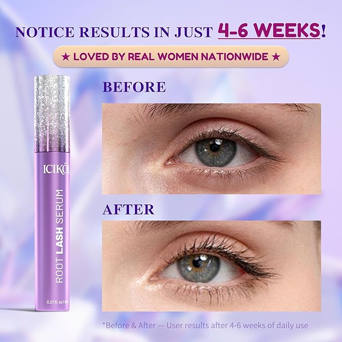 ICIKOL Lash Serum for Eyelash Growth, Premium Lash Enhancing Serum for Women & Men with Advanced Formula Volumizing Longer Fuller and Thicker Looking Lashes, Vegan & Cruelty-Free