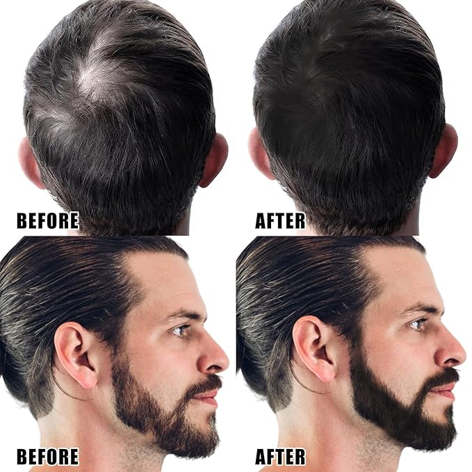 KGAJSGH Men's Beard Pencil & Powder Stick, Micro Fork Tip Beard Filler, Waterproof Beard Color Pen for Natural Looking Beard Mustache, Eyebrows, Hairline Coverage, Waterproof
