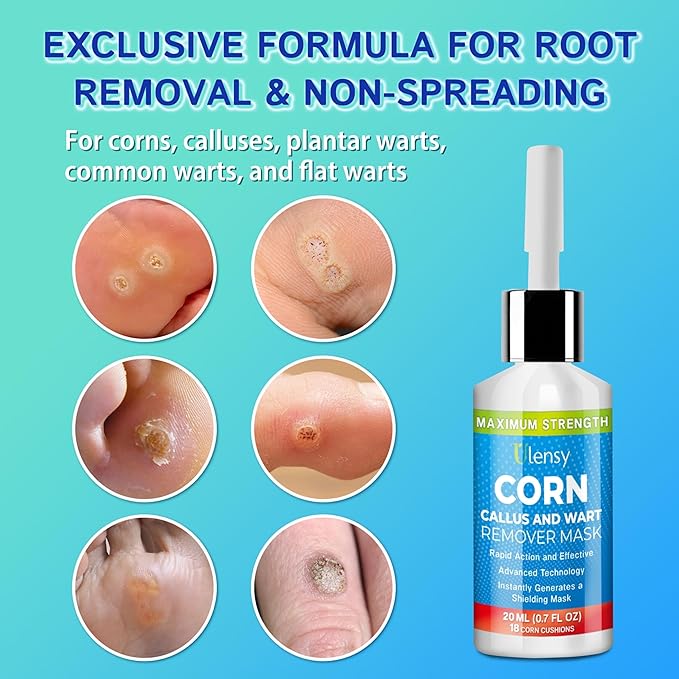 Ulensy Corn Remover Liquid for Toes Feet: 20ml Salicylic Acid for Foot Corns Calluses Wart Removal at Work Home - Safe for Kids Teens Adults Seniors Athletes Runners Workers Men Women