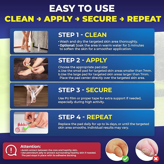 Ulensy Corn Remover Pads for Feet Toes: 2 Boxes of 30 Pack Salicylic Acid Extra Strength Treatment - Fast Effective Medicated Bandages for Kids Adults Seniors Teens Runners Workers Men Women 60 Blue
