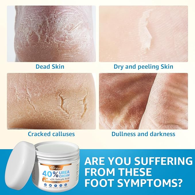 DR.Afanyr 40% Urea Cream for Feet – Foot Cream with 2% Salicylic Acid for Dry Cracked Heels and Feet, Urea 40% Foot Lotion, Formulated with Shea Butter, Tea Tree Oil for Deep Moisturizing(5.29oz)