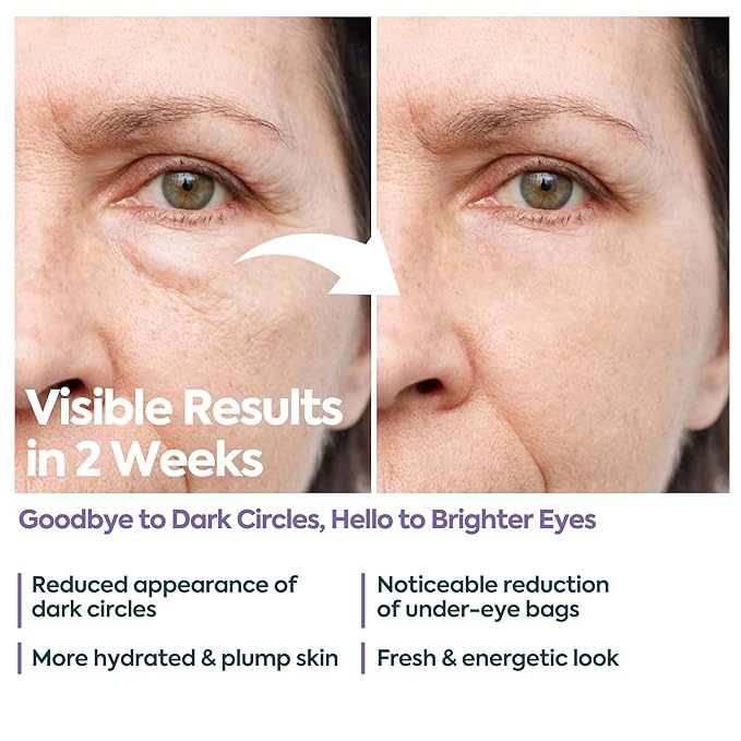 Under Eye Cream for Dark Circles and Puffiness – 5% Caffeine + 2% Hyaluronic Acid – Eye Brightening Cream for Wrinkles, Bags, Fine Lines – Korean Eye Cream for Women