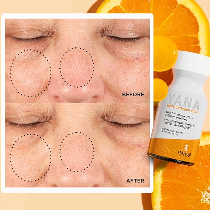 IMAGE Skincare, YANA Liquid Collagen Shots, 2500 mg Hydrolyzed Bovine Collagen Peptide Supplement with Biotin, Natural Citrus Flavor, 28 Daily Shots