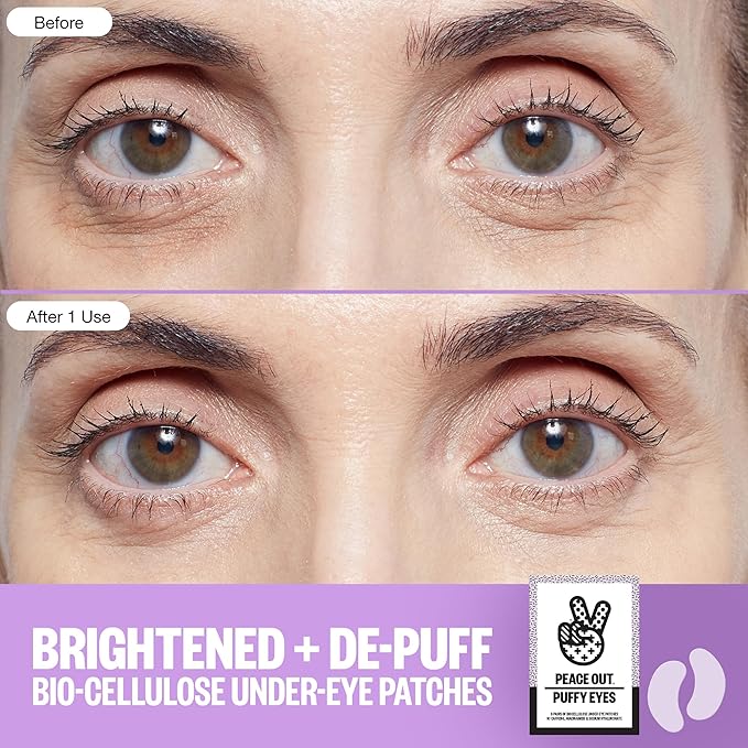 PEACE OUT Skincare Puffy Eyes Under Eye Patches, Biocellulose Eye Masks with Caffeine and Niacinamide for Under Eye Puffiness and Tired Eyes, 6 Pairs
