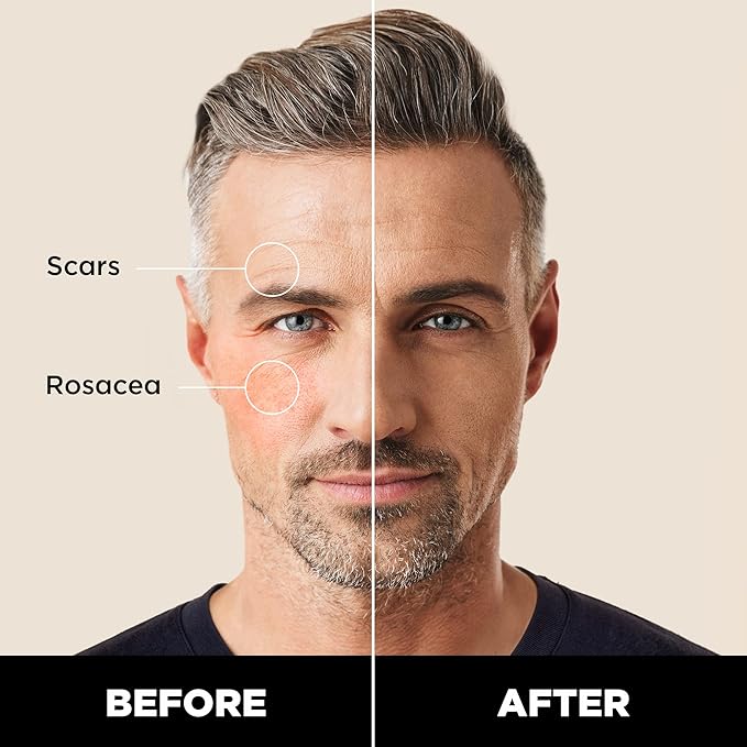 Stryx Concealer Stick Tool for Men, Medium Mahogany - Natural Pigments Hides Imperfections, Acne, Razor Burns, Scars, & Rosacea - Highly Adaptable Shades for Easy, Undetectable Coverage
